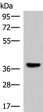 Western blot analysis of Mouse liver tissue lysate  using LRG1 Polyclonal Antibody at dilution of 1:1000