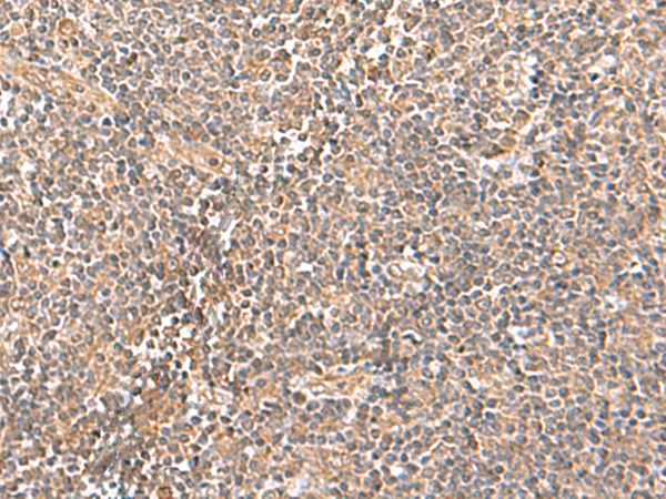 Immunohistochemistry of paraffin-embedded Human tonsil tissue  using TRUB1 Polyclonal Antibody at dilution of 1:70(×200)