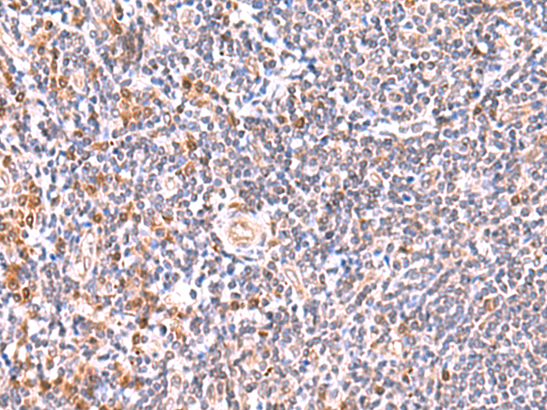 Immunohistochemistry of paraffin-embedded Human tonsil tissue  using GMDS Polyclonal Antibody at dilution of 1:55(×200)