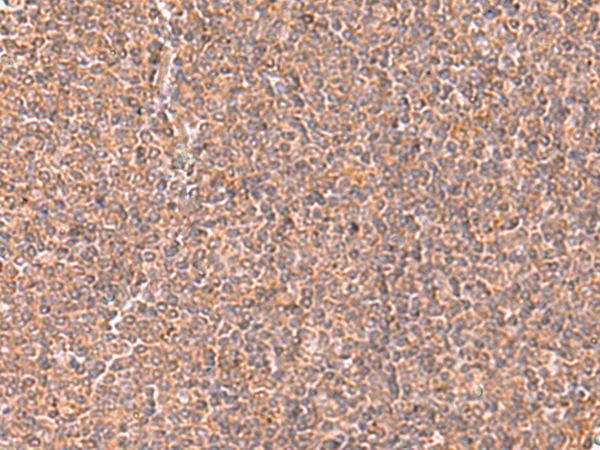 Immunohistochemistry of paraffin-embedded Human tonsil tissue  using RABEPK Polyclonal Antibody at dilution of 1:65(×200)