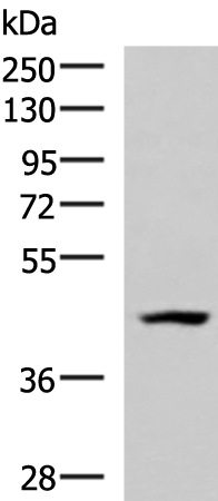 Western blot analysis of 293T cell lysate  using MAGEC2 Polyclonal Antibody at dilution of 1:700