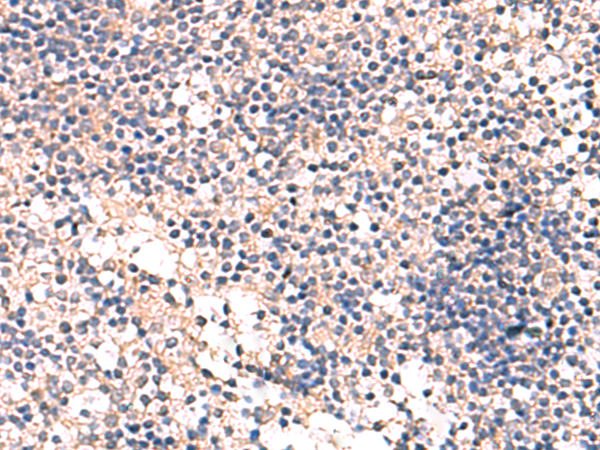 Immunohistochemistry of paraffin-embedded Human tonsil tissue  using MKS1 Polyclonal Antibody at dilution of 1:50(×200)