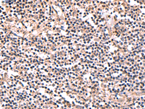 Immunohistochemistry of paraffin-embedded Human tonsil tissue  using PER3 Polyclonal Antibody at dilution of 1:70(×200)
