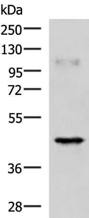 Western blot analysis of Human muscle tissue lysate  using RAB3IL1 Polyclonal Antibody at dilution of 1:1000