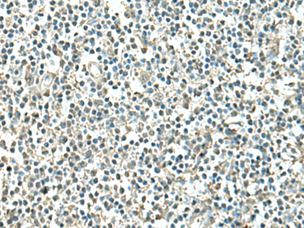Immunohistochemistry of paraffin-embedded Human tonsil tissue  using ATP6V1C1 Polyclonal Antibody at dilution of 1:100(×200)