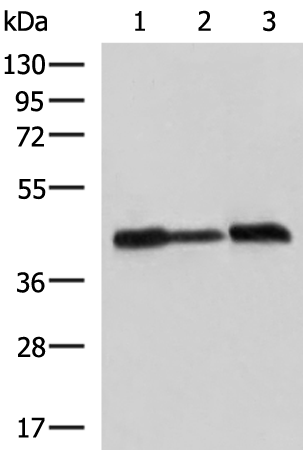 Western blot analysis of A549 Hela and HepG2 cell lysates  using PDHA1 Polyclonal Antibody at dilution of 1:750