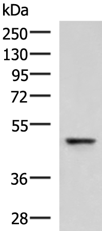 Western blot analysis of Human fetal liver tissue lysate  using RMDN2 Polyclonal Antibody at dilution of 1:750