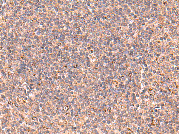 Immunohistochemistry of paraffin-embedded Human tonsil tissue  using UBAC1 Polyclonal Antibody at dilution of 1:60(×200)