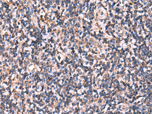 Immunohistochemistry of paraffin-embedded Human tonsil tissue  using RHAG Polyclonal Antibody at dilution of 1:110(×200)