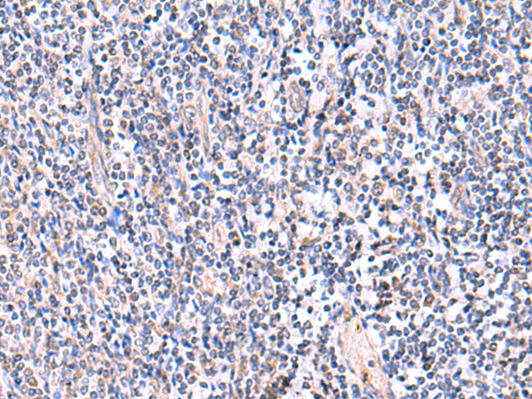 Immunohistochemistry of paraffin-embedded Human tonsil tissue  using FDFT1 Polyclonal Antibody at dilution of 1:75(×200)
