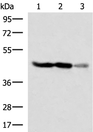 Western blot analysis of HT29 and HepG2 cell Human fetal brain tissue lysates  using FDFT1 Polyclonal Antibody at dilution of 1:1000