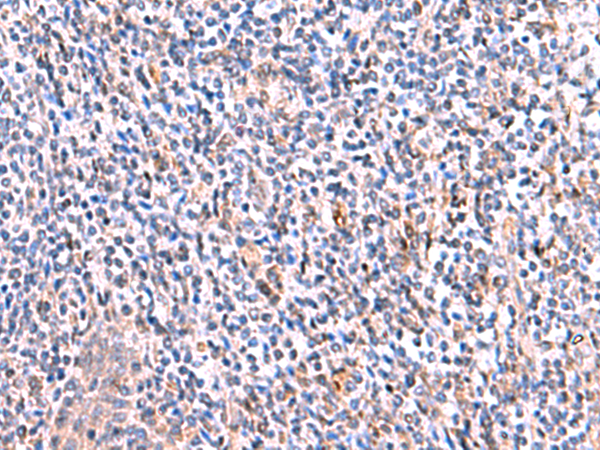 Immunohistochemistry of paraffin-embedded Human tonsil tissue  using SMPD2 Polyclonal Antibody at dilution of 1:70(×200)