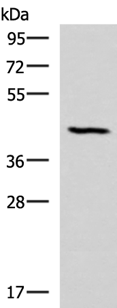 Western blot analysis of Mouse lung tissue lysate  using SMPD2 Polyclonal Antibody at dilution of 1:1000