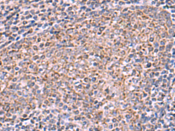 Immunohistochemistry of paraffin-embedded Human tonsil tissue  using ECSIT Polyclonal Antibody at dilution of 1:75(×200)