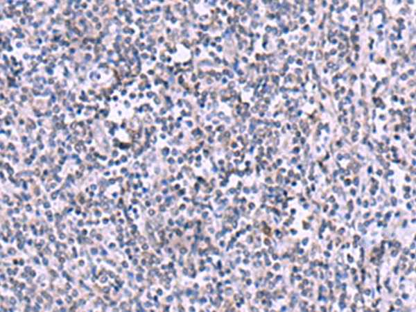 Immunohistochemistry of paraffin-embedded Human tonsil tissue  using KIR3DL1 Polyclonal Antibody at dilution of 1:105(×200)