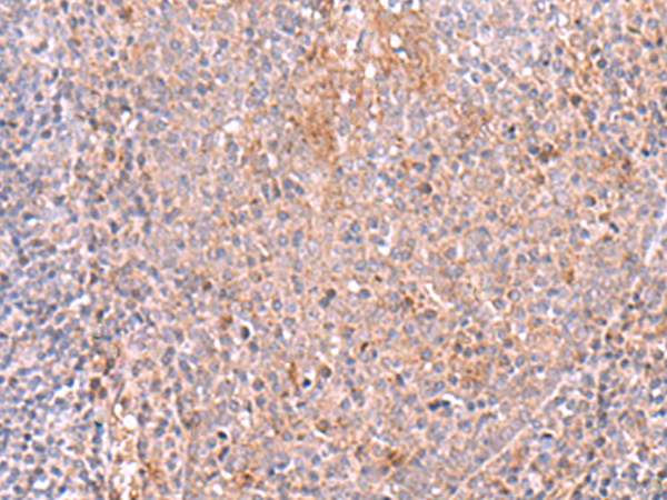 Immunohistochemistry of paraffin-embedded Human tonsil tissue  using ZSWIM1 Polyclonal Antibody at dilution of 1:55(×200)