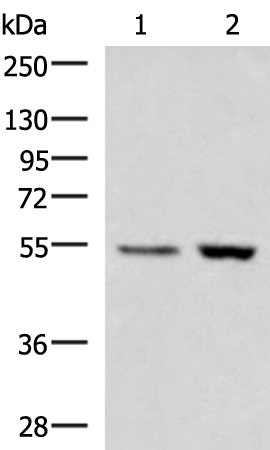 Western blot analysis of Human placenta tissue LOVO cell lysates  using ZSWIM1 Polyclonal Antibody at dilution of 1:550