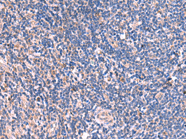 Immunohistochemistry of paraffin-embedded Human tonsil tissue  using MPP1 Polyclonal Antibody at dilution of 1:50(×200)