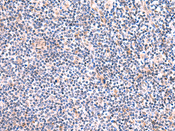 Immunohistochemistry of paraffin-embedded Human tonsil tissue  using FUCA2 Polyclonal Antibody at dilution of 1:80(×200)