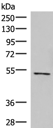 Western blot analysis of Jurkat cell lysate  using POLD2 Polyclonal Antibody at dilution of 1:800