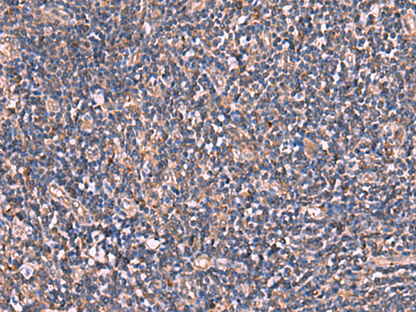 Immunohistochemistry of paraffin-embedded Human tonsil tissue  using TTC38 Polyclonal Antibody at dilution of 1:85(×200)