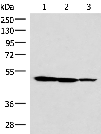 Western blot analysis of HepG2 K562 and A172 cell lysates  using TTC38 Polyclonal Antibody at dilution of 1:1000