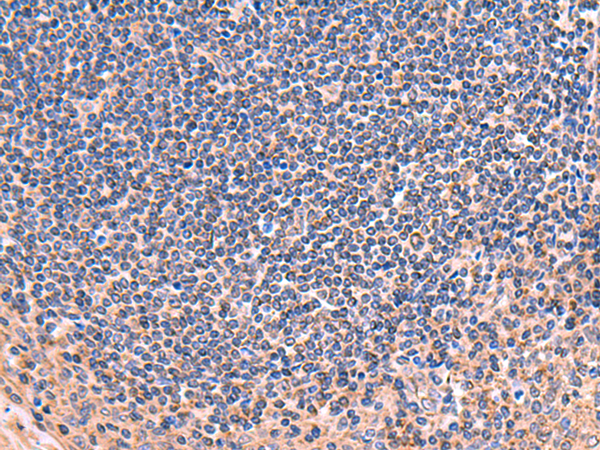 Immunohistochemistry of paraffin-embedded Human tonsil tissue  using ZNF256 Polyclonal Antibody at dilution of 1:70(×200)