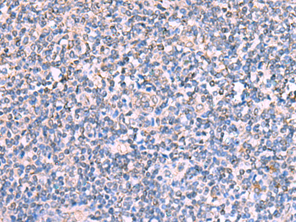 Immunohistochemistry of paraffin-embedded Human tonsil tissue  using FDXR Polyclonal Antibody at dilution of 1:110(×200)