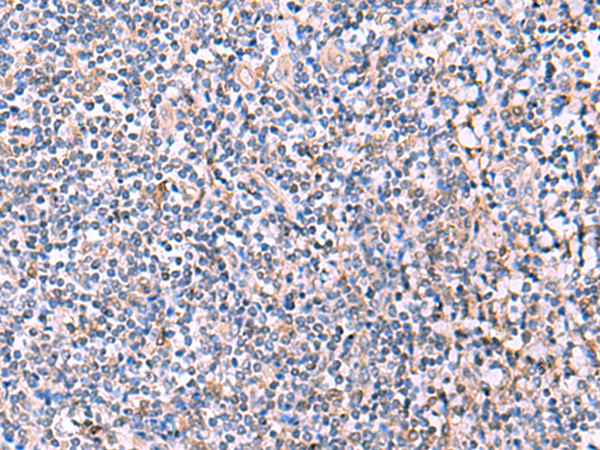 Immunohistochemistry of paraffin-embedded Human tonsil tissue  using PEPD Polyclonal Antibody at dilution of 1:85(×200)