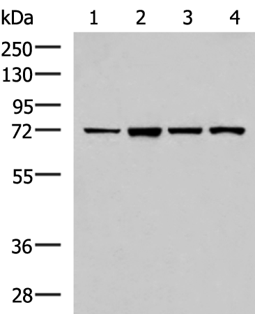 Western blot analysis of Jurkat cell Mouse liver tissue HepG2 cell Mouse kidney tissue lysates  using ZAP70 Polyclonal Antibody at dilution of 1:800