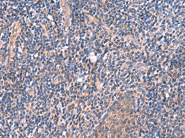 Immunohistochemistry of paraffin-embedded Human tonsil tissue  using MYOT Polyclonal Antibody at dilution of 1:70(×200)