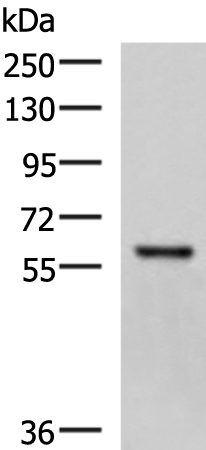 Western blot analysis of Mouse skeletal muscle tissue lysate  using MYOT Polyclonal Antibody at dilution of 1:1000