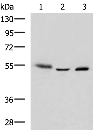 Western blot analysis of Human skin tissue A172 cell Human bladder transitional cell carcinoma grade 2-3 tissue lysates  using IKZF2 Polyclonal Antibody at dilution of 1:950