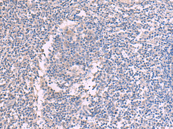 Immunohistochemistry of paraffin-embedded Human tonsil tissue  using CCT5 Polyclonal Antibody at dilution of 1:60(×200)