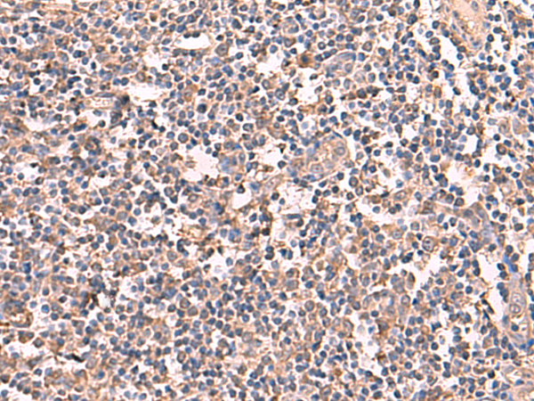 Immunohistochemistry of paraffin-embedded Human tonsil tissue  using RIOK1 Polyclonal Antibody at dilution of 1:60(×200)