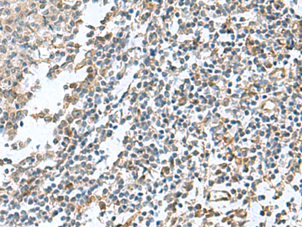 Immunohistochemistry of paraffin-embedded Human tonsil tissue  using PAPSS2 Polyclonal Antibody at dilution of 1:95(×200)