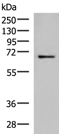 Western blot analysis of 231 cell lysate  using GSPT2 Polyclonal Antibody at dilution of 1:650