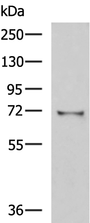 Western blot analysis of Mouse kidney tissue lysate  using GSTCD Polyclonal Antibody at dilution of 1:1000