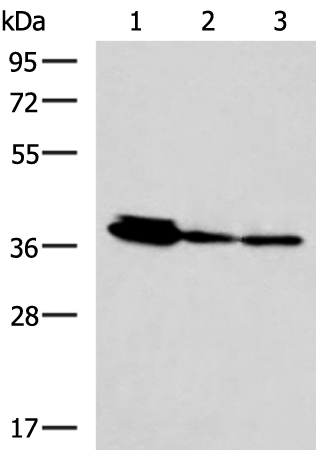 Western blot analysis of HepG2 A172 and A549 cell lysates  using EEF1D Polyclonal Antibody at dilution of 1:800