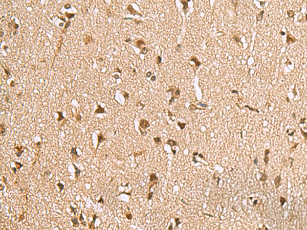 Immunohistochemistry of paraffin-embedded Human brain tissue  using NVL Polyclonal Antibody at dilution of 1:70(×200)