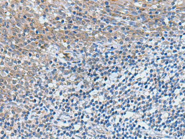Immunohistochemistry of paraffin-embedded Human tonsil tissue  using GPCPD1 Polyclonal Antibody at dilution of 1:50(×200)