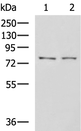 Western blot analysis of K562 cell Mouse liver tissue lysates  using GPCPD1 Polyclonal Antibody at dilution of 1:650