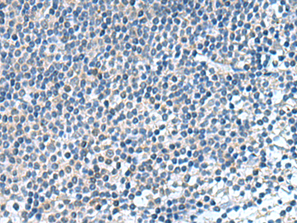 Immunohistochemistry of paraffin-embedded Human tonsil tissue  using KIF2A Polyclonal Antibody at dilution of 1:65(×200)