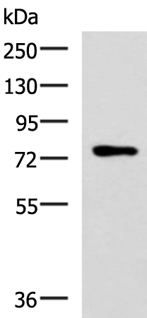 Western blot analysis of Mouse thymus tissue lysate  using L3MBTL2 Polyclonal Antibody at dilution of 1:800