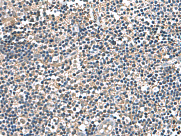 Immunohistochemistry of paraffin-embedded Human tonsil tissue  using IP6K2 Polyclonal Antibody at dilution of 1:140(×200)