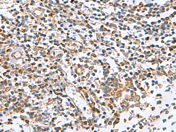 Immunohistochemistry of paraffin-embedded Human tonsil tissue  using AP1S3 Polyclonal Antibody at dilution of 1:55(×200)