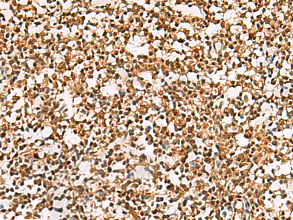 Immunohistochemistry of paraffin-embedded Human tonsil tissue  using PHF5A Polyclonal Antibody at dilution of 1:55(×200)