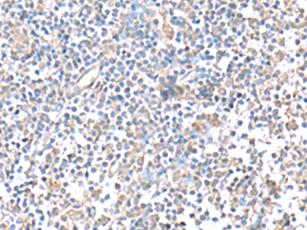 Immunohistochemistry of paraffin-embedded Human tonsil tissue  using IFI27 Polyclonal Antibody at dilution of 1:80(×200)