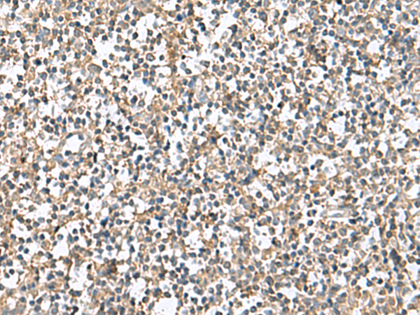 Immunohistochemistry of paraffin-embedded Human tonsil tissue  using PTPRS Polyclonal Antibody at dilution of 1:110(×200)