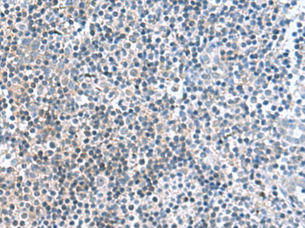 Immunohistochemistry of paraffin-embedded Human tonsil tissue  using FAM107B Polyclonal Antibody at dilution of 1:160(×200)